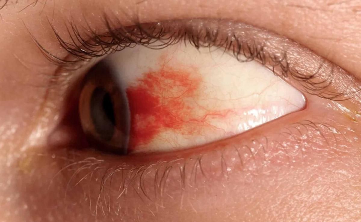 unam-desarrolla-gotas-oftalmicas-basadas-en-la-vasoinhibina-para-tratar-la-retinopatia-diabetica